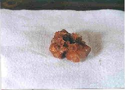 aragonite